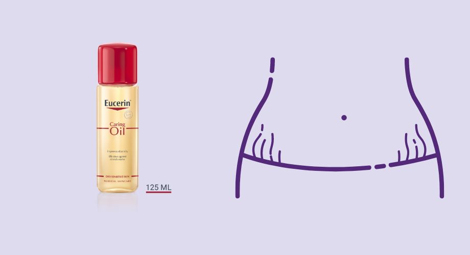 Ulje za strije u trudnoći Eucerin