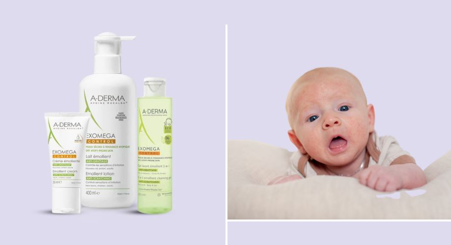 A-Derma Exomega linija proizvoda s Rhealba zobi, koja smanjuje upalu i umiruje nadraženu kožu.