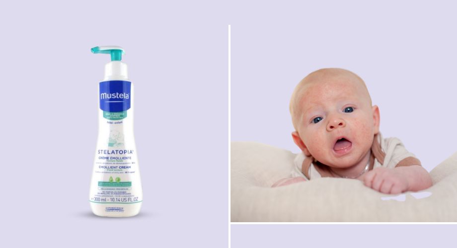 Mustela Stelatopia emolijentna hidratantna krema – hidratizira i obnavlja kožnu barijeru.