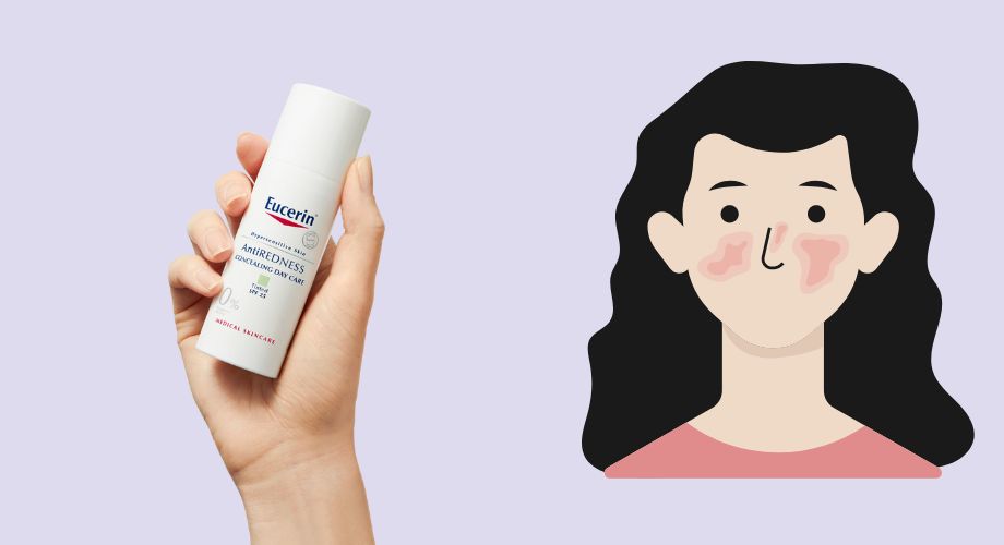 Rozacea krema Eucerin